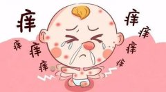 南京皮炎所哪个医生看湿疹厉害？