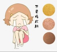 小孩身上有鸡皮疙瘩要治疗吗