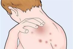 �ŵ׳�ʪ�������ô��